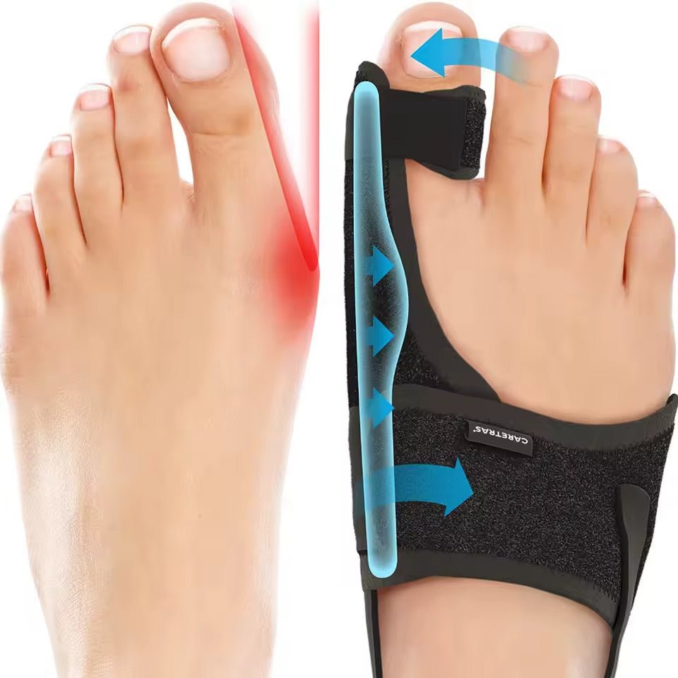 Férula Nocturna Hallux Valgus - Confort Ergonómico y Ajustable